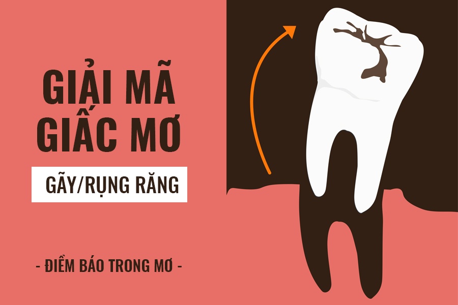 Giải mã giấc mơ liên quan đến gãy răng